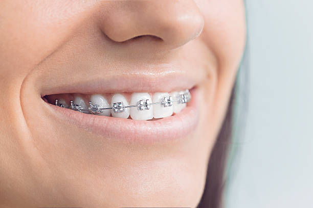 Laser Dentistry in Kenner, LA